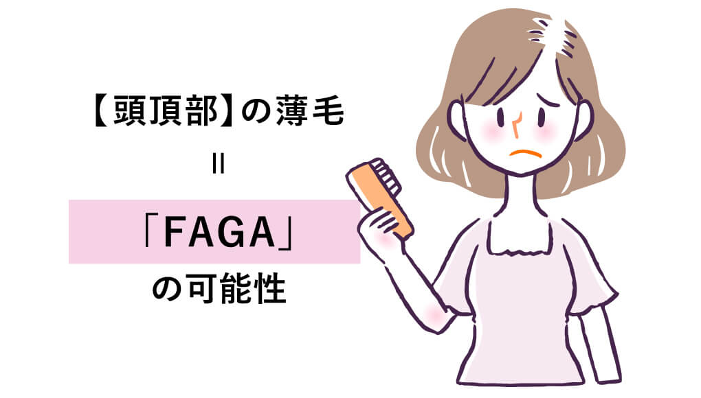 女性の頭頂部の薄毛は「FAGA」の可能性