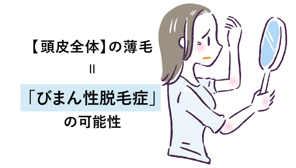 女性の頭皮全体の薄毛は「びまん性脱毛症」の可能性