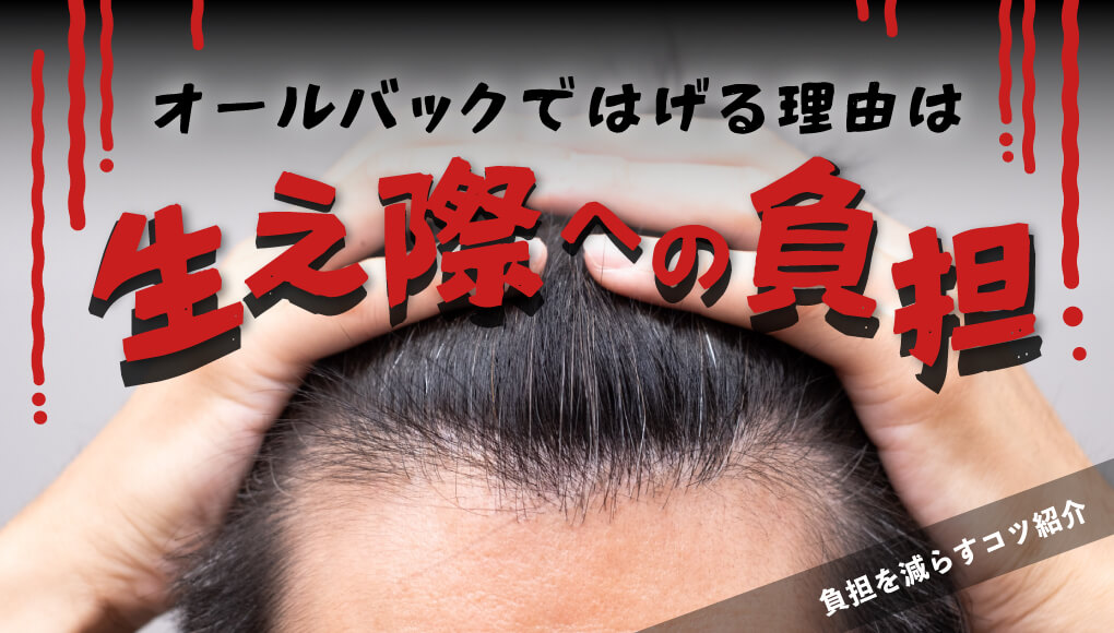 【はげない方法解説】オールバックではげる理由は“生え際の負担”