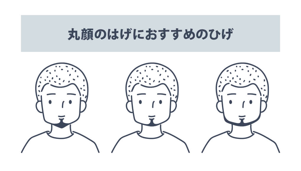 丸顔のはげにおすすめのひげ