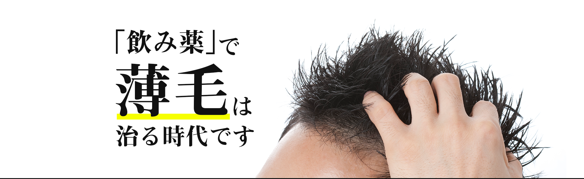 飲み薬で薄毛は治る時代です