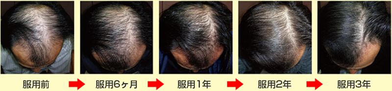 期間ごとの服用効果