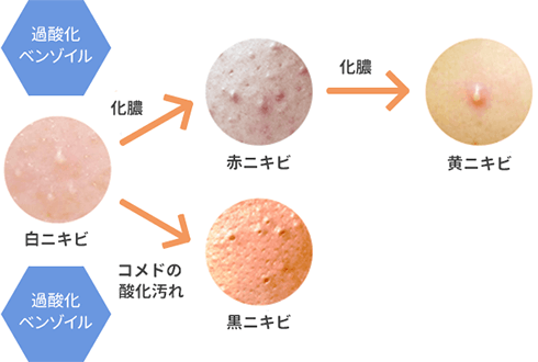 年齢と共に増えるシミ・しわに対策イメージ