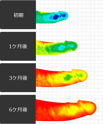ペニス成長イメージ