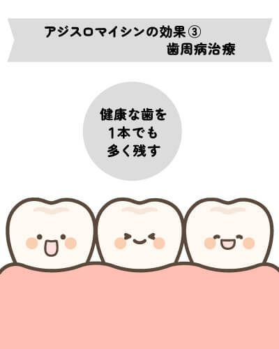 アジスロマイシンの効果③（歯周病治療効果）