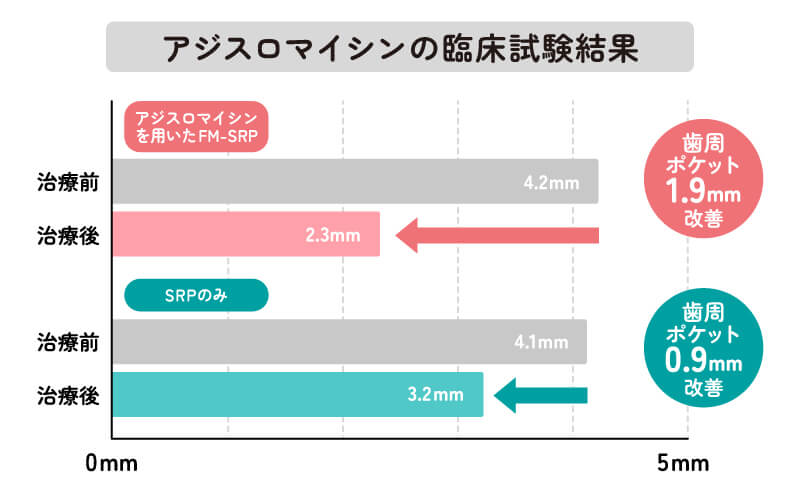 アジスロマイシンの臨床試験結果（歯周病）