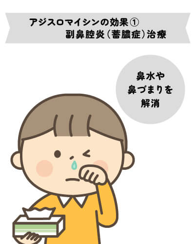 アジスロマイシンの効果④（副鼻腔炎（蓄膿症））