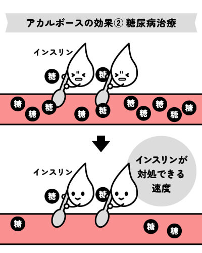 アカルボースの効果②糖尿病治療効果