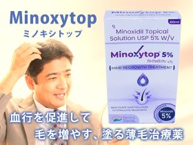 ミノキシトップの概要