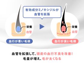 ミノキシトップの効果