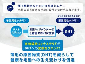 プロペシアの効果
