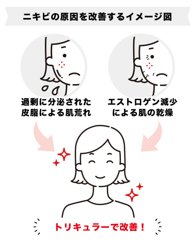 トリキュラーによるニキビ改善イラスト