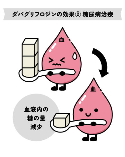 ダパグリフロジンの効果②糖尿病治療