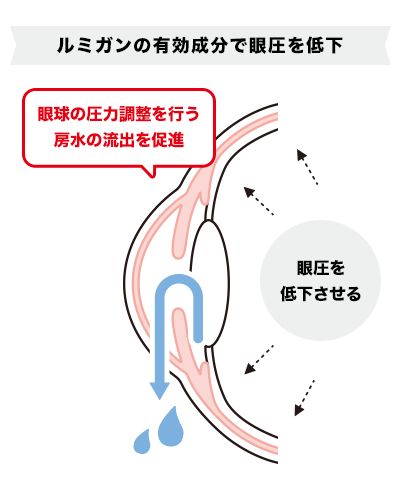ルミガンが眼球の圧力調整を行い、緑内障や高眼圧症を治療するイラスト