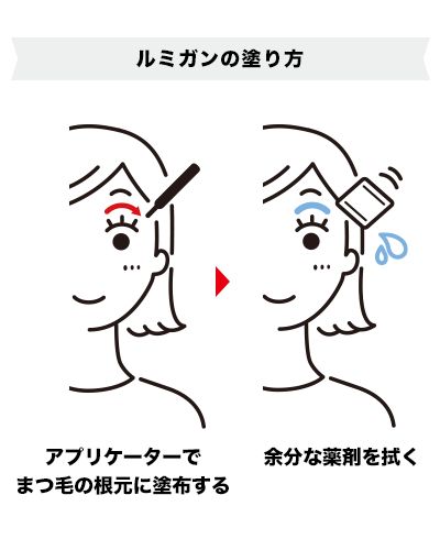 ルミガンをまつ毛の育毛に用いる際の使い方解説イラスト