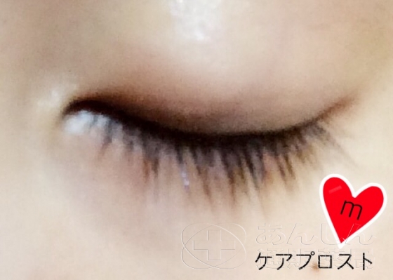 ケアプロストの口コミ画像