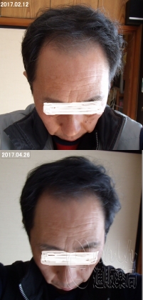 ミノキシトップの口コミ画像