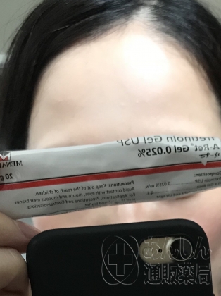 エーレットジェルの口コミ画像