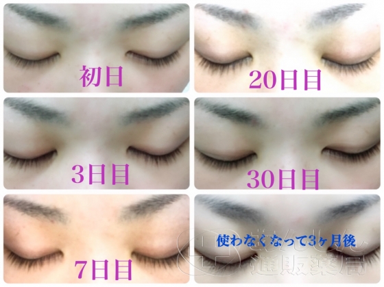 ビマトアイドロップスの口コミ画像