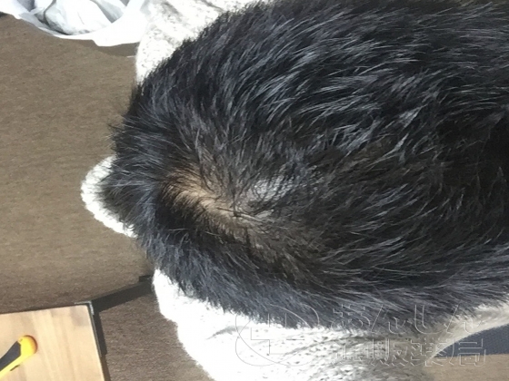 フィンペシアの口コミ画像