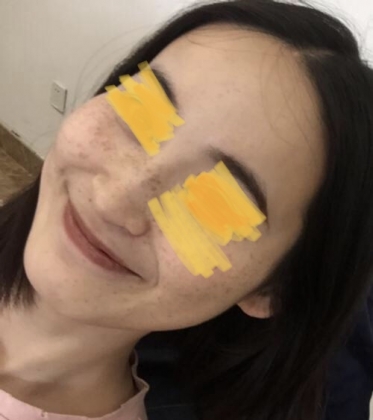 ユークロマプラスクリームの口コミ画像