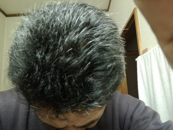 ロニタブの口コミ画像