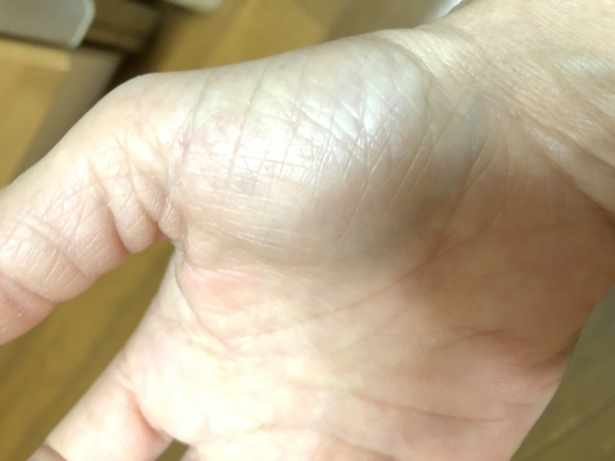 プラセントレックスクリームの口コミ画像