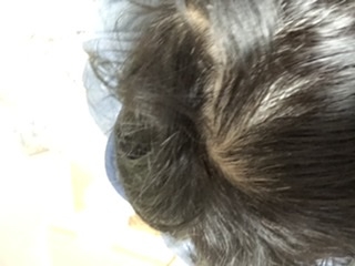 フィンペシアの口コミ画像