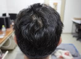 フィンペシアの口コミ画像