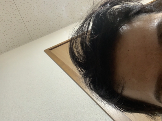 ニゾラールシャンプーの口コミ画像