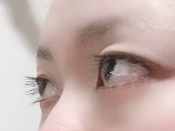ケアプロストの口コミ画像