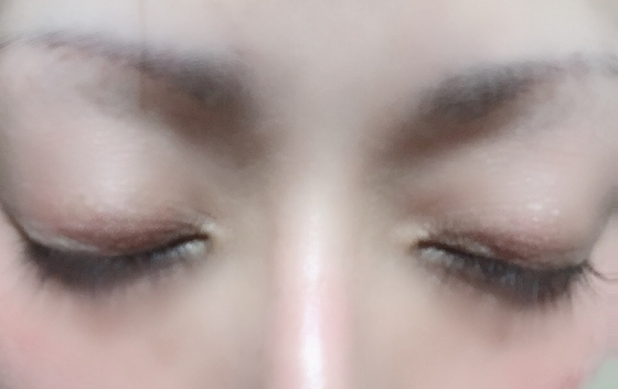 ケアプロストの口コミ画像