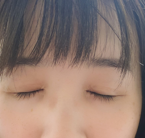 ルミガンの口コミ画像