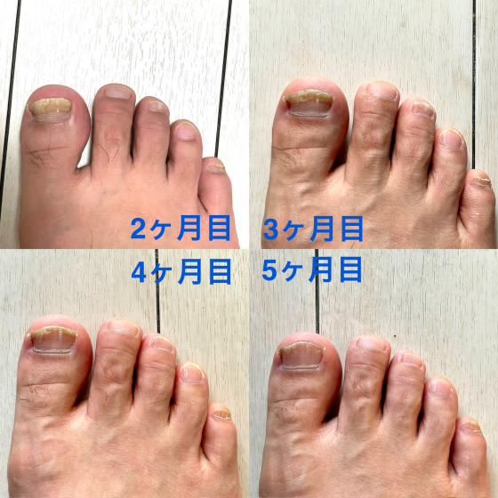 セビフィンの口コミ画像