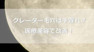「手遅れだ」と言われるクレーター毛穴を医療美容で改善！