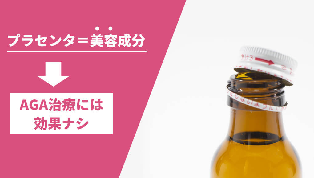 男性の薄毛にプラセンタは殆ど効果がない。AGAは美容成分では治らないぞ